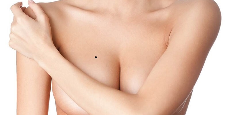 Dấu vết xuất hiện ở ngực người phụ nữ